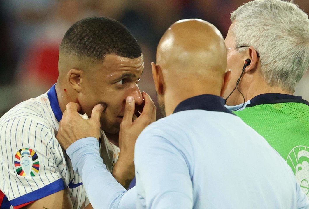 El delantero francés Kylian Mbappe es atendido por los médicos durante el partido que han jugado Austria y Francia en Dusseldorf, Alemania. EFE/EPA/FRIEDEMANN VOGEL